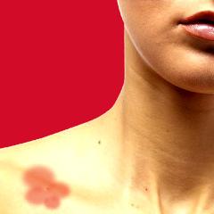 Le psoriasis les conseils des guéris